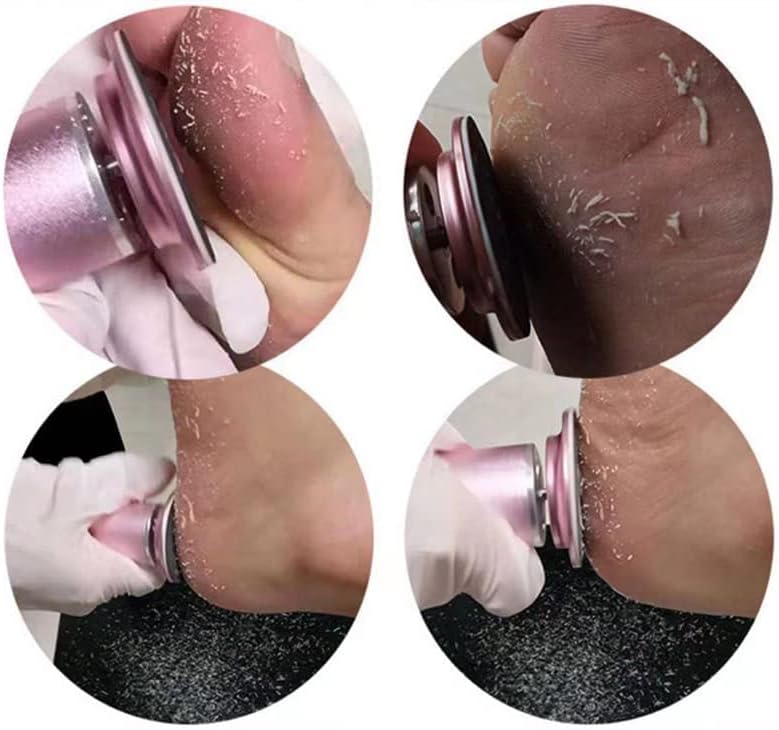 Kav™ Electric Foot Callus Remover